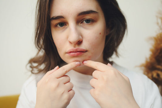 Why You're Breaking Out & How Dark N Glow Has The Answer